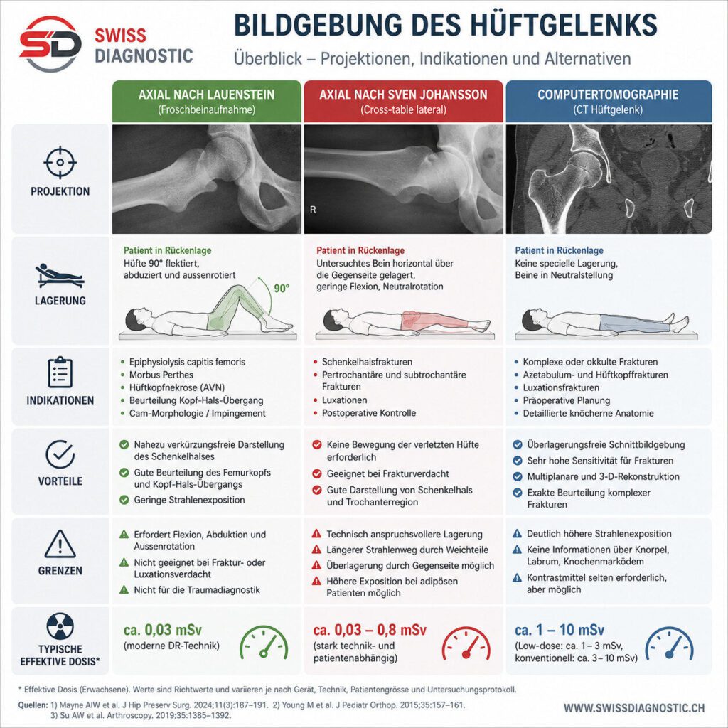 Infografik zum Vergleich der Hüftbildgebung mit axialer Aufnahme nach Lauenstein, axialer Aufnahme nach Sven Johansson und Computertomographie (CT) mit Indikationen, Lagerung, Vorteilen und Strahlenexposition.